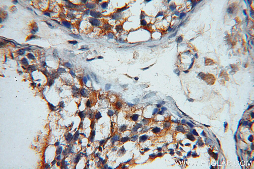 Immunohistochemistry (IHC) staining of human testis tissue using DLEC1 Polyclonal antibody (20027-1-AP)