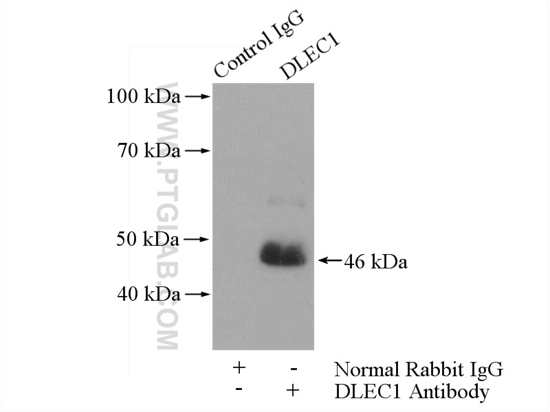 Immunoprecipitation (IP) experiment of PC-3 cells using DLEC1 Polyclonal antibody (20027-1-AP)