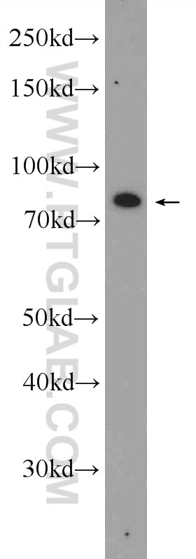 Western Blot (WB) analysis of PC-3 cells using DLEC1 Polyclonal antibody (20027-1-AP)