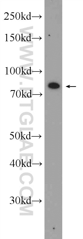 WB analysis of PC-3 using 20027-1-AP