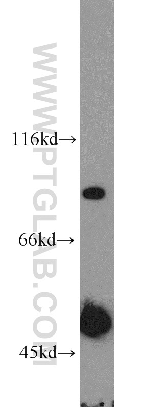 Western Blot (WB) analysis of human testis tissue using DLEC1 Polyclonal antibody (20027-1-AP)