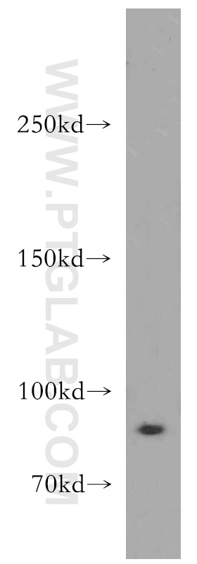 Western Blot (WB) analysis of A549 cells using DLEC1 Polyclonal antibody (20027-1-AP)