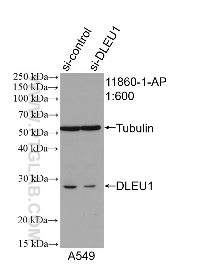 Western Blot (WB) analysis of A549 cells using DLEU1 Polyclonal antibody (11860-1-AP)