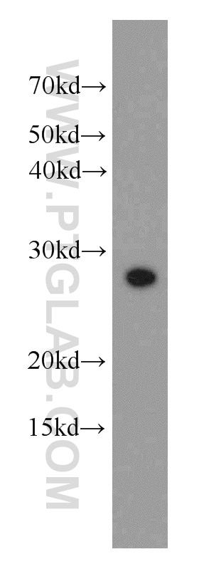 Western Blot (WB) analysis of K-562 cells using DLEU1 Polyclonal antibody (11860-1-AP)