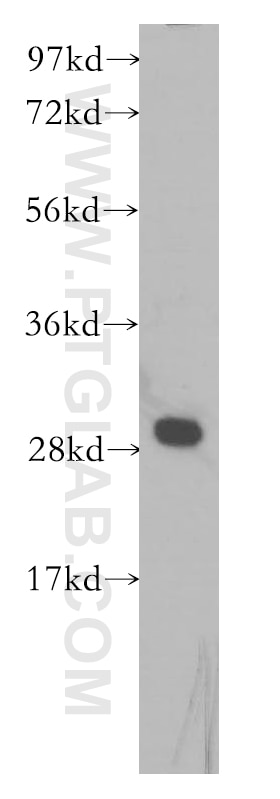 Western Blot (WB) analysis of K-562 cells using DLEU1 Polyclonal antibody (11860-1-AP)