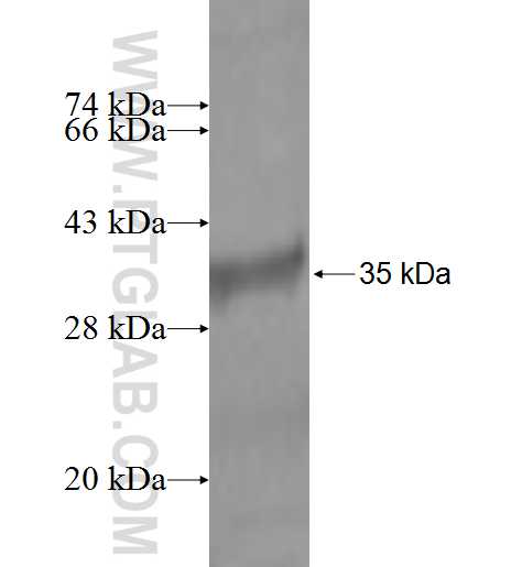 DLEU1 fusion protein Ag2435 SDS-PAGE
