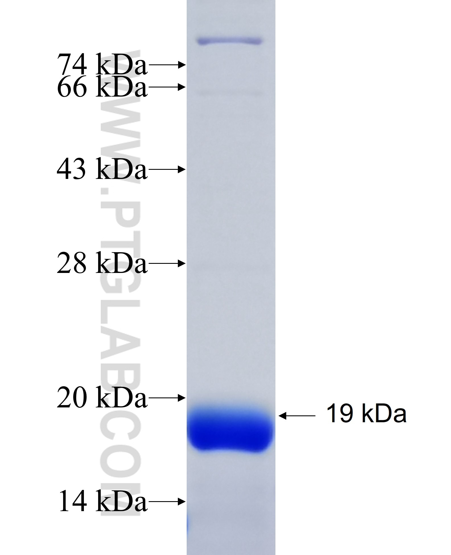 DLEU7 fusion protein Ag35005 SDS-PAGE DLEU7 fusion protein Ag35005 SDS-PAGE