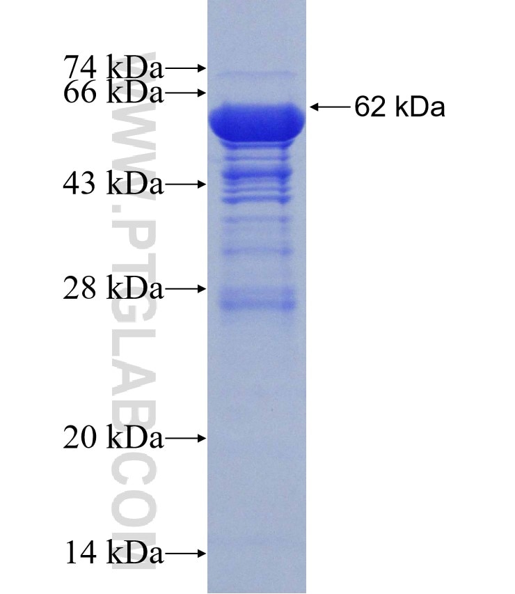 DLG1 fusion protein Ag31066 SDS-PAGE