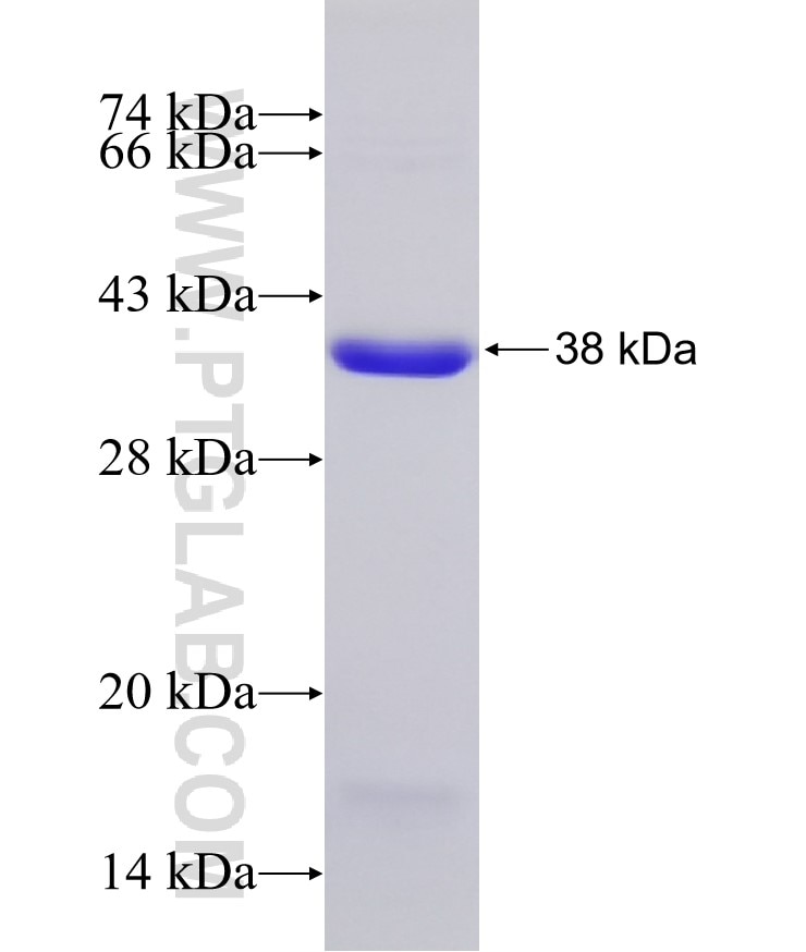 DLG1-spot tag fusion protein Ag31615 SDS-PAGE