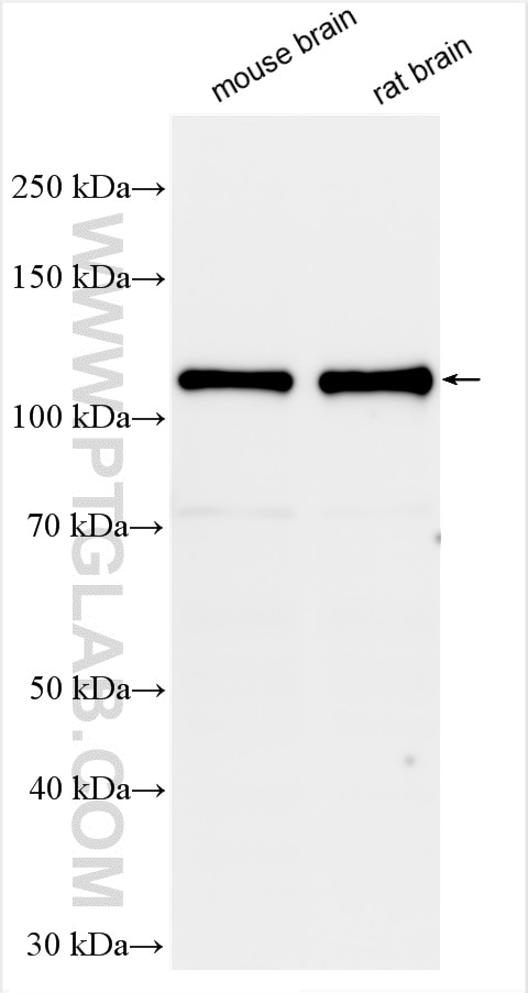 Western Blot (WB) analysis of various lysates using DLG2 Polyclonal antibody (29457-1-AP)