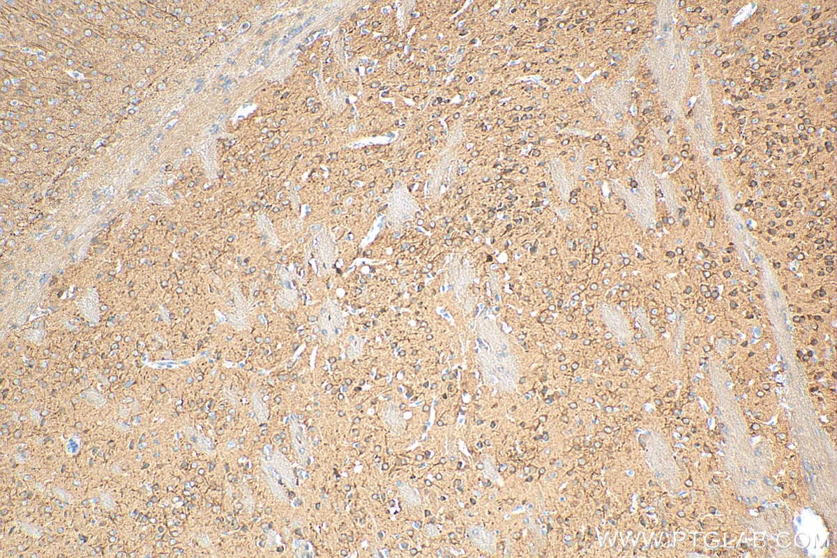 Immunohistochemistry (IHC) staining of mouse brain tissue using SAP102 Polyclonal antibody (18036-1-AP)