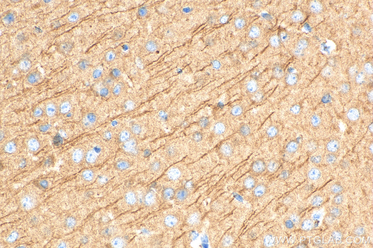 Immunohistochemistry (IHC) staining of mouse brain tissue using SAP102 Polyclonal antibody (18036-1-AP)