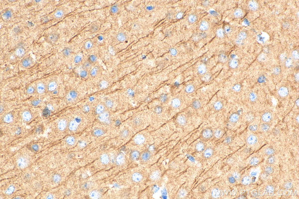 IHC staining of mouse brain using 18036-1-AP