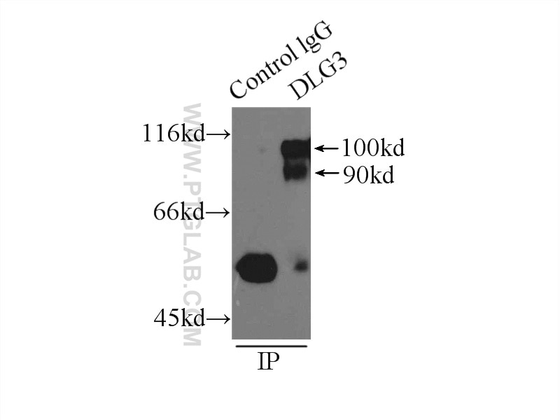 Immunoprecipitation (IP) experiment of mouse brain tissue using SAP102 Polyclonal antibody (18036-1-AP)