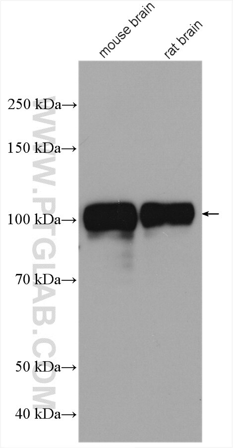 Western Blot (WB) analysis of various lysates using SAP102 Polyclonal antibody (18036-1-AP)