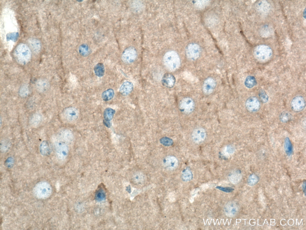 Immunohistochemistry (IHC) staining of mouse brain tissue using SAP102 Monoclonal antibody (67102-1-Ig)