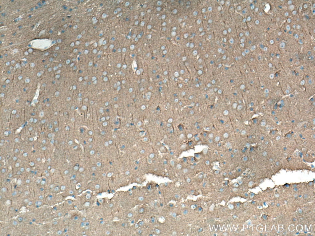 IHC staining of mouse brain using 67102-1-Ig