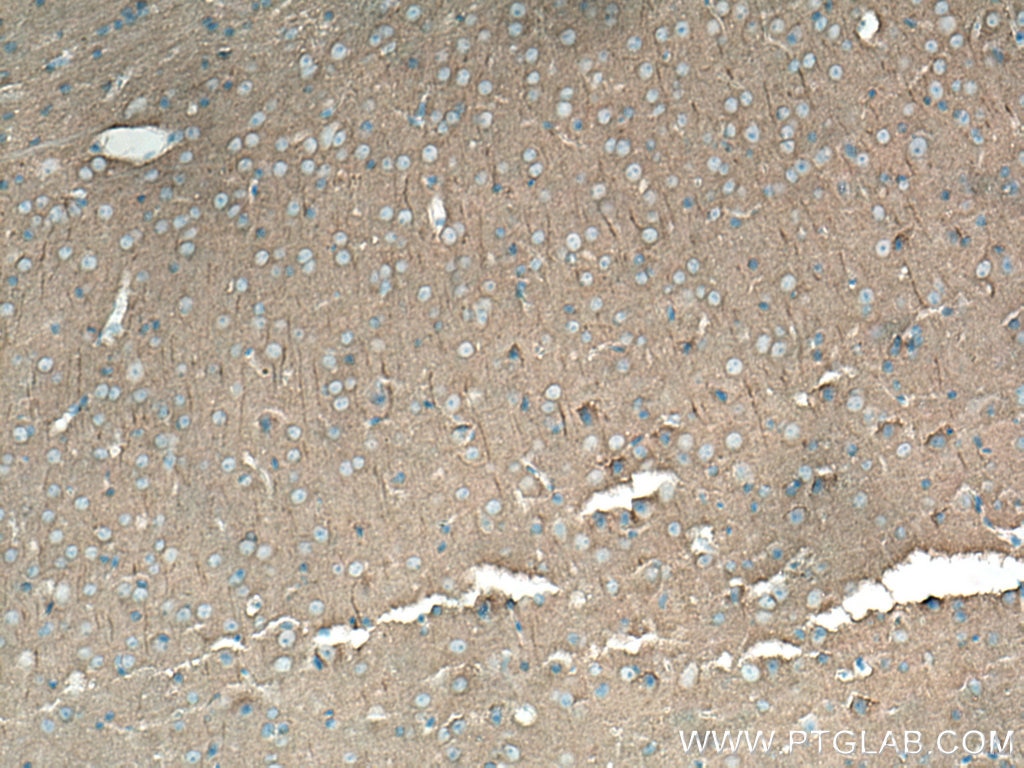 Immunohistochemistry (IHC) staining of mouse brain tissue using SAP102 Monoclonal antibody (67102-1-Ig)