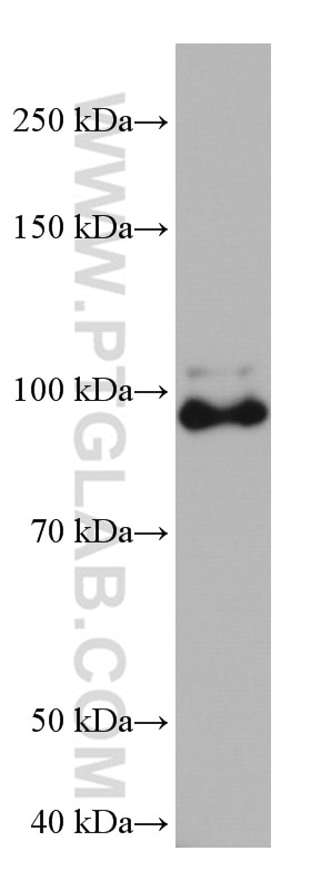 Western Blot (WB) analysis of rat brain tissue using SAP102 Monoclonal antibody (67102-1-Ig)