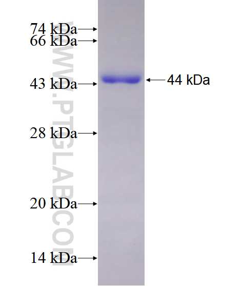DLG3 fusion protein Ag28589 SDS-PAGE