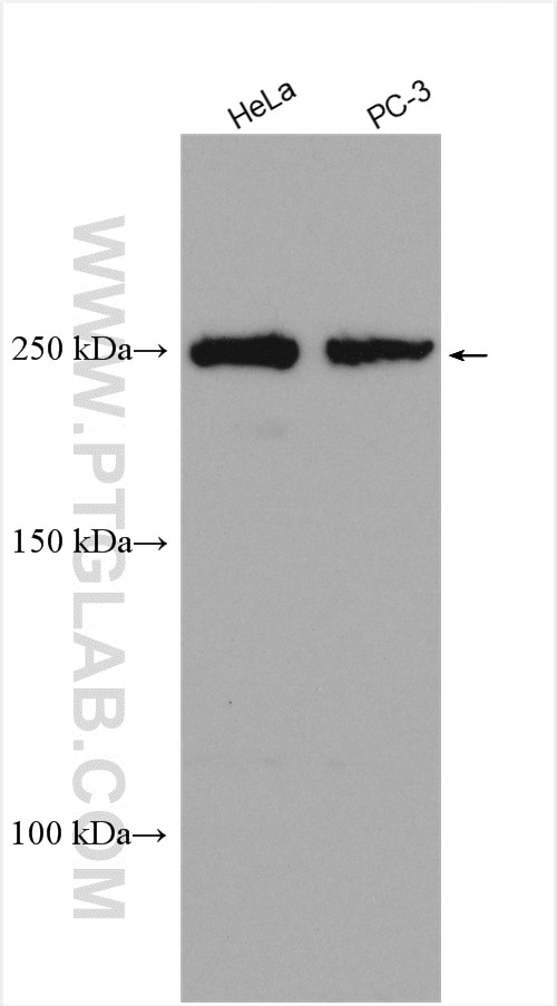 Western Blot (WB) analysis of various lysates using DLG5 Polyclonal antibody (15687-1-AP)