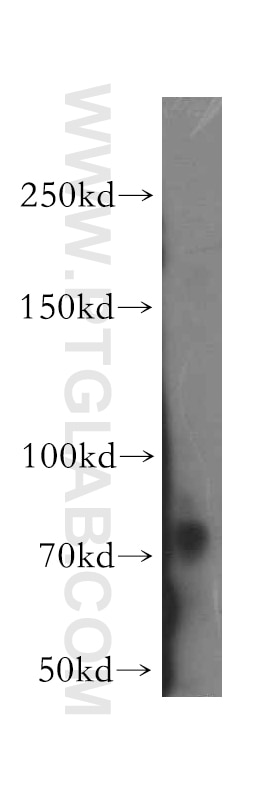 Western Blot (WB) analysis of mouse kidney tissue using DLG5 Polyclonal antibody (15687-1-AP)