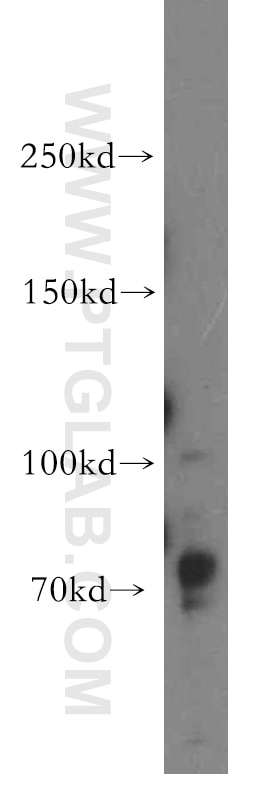 Western Blot (WB) analysis of PC-3 cells using DLG5 Polyclonal antibody (15687-1-AP)
