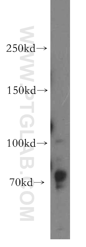 WB analysis of PC-3 using 15687-1-AP