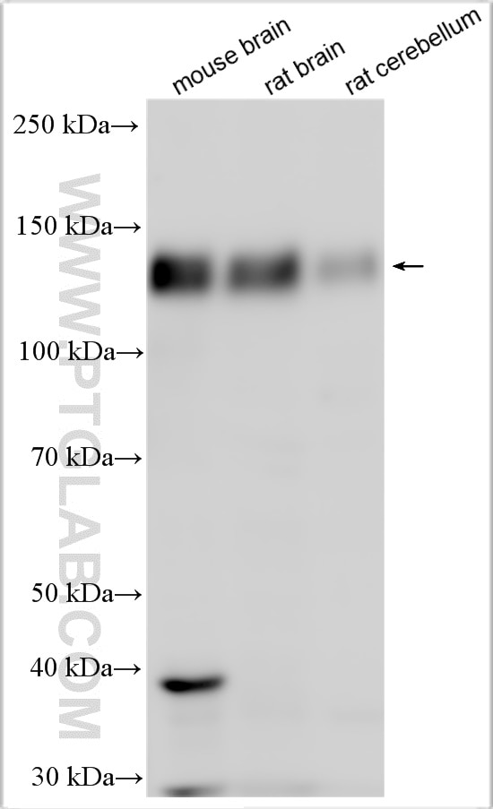 Western Blot (WB) analysis of various lysates using DLGAP1 Polyclonal antibody (28124-1-AP)