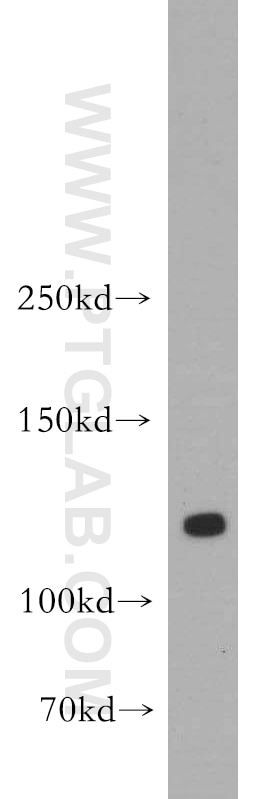 Western Blot (WB) analysis of human brain tissue using DLGAP3 Polyclonal antibody (55056-1-AP)