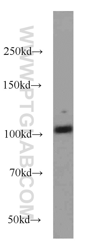 Western Blot (WB) analysis of mouse brain tissue using DLGAP3 Polyclonal antibody (55056-1-AP)