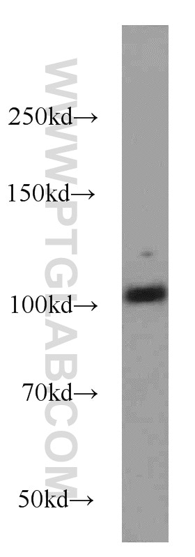 WB analysis of mouse brain using 55056-1-AP