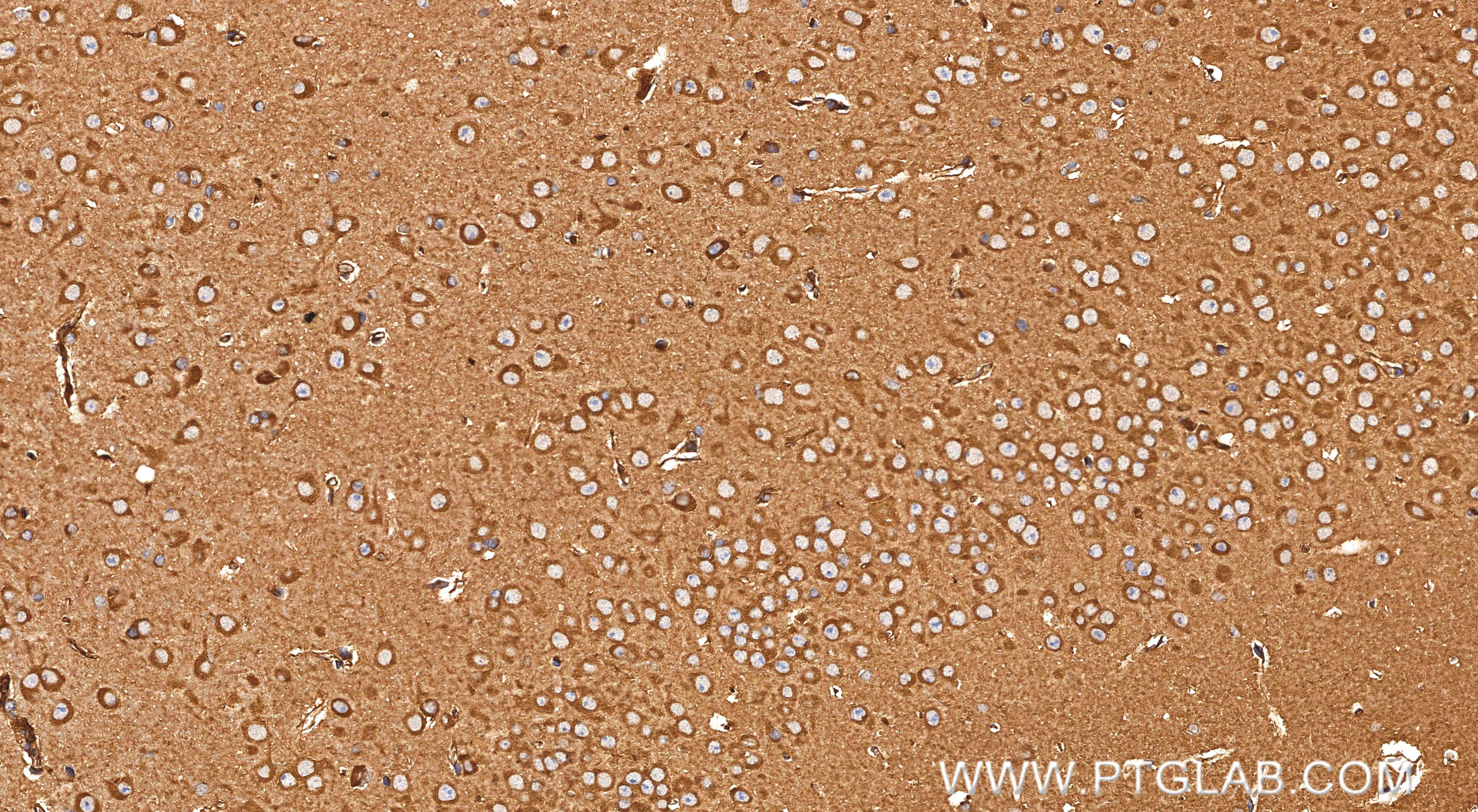 Immunohistochemistry (IHC) staining of mouse brain tissue using DLGAP3 Recombinant monoclonal antibody (85695-1-RR)