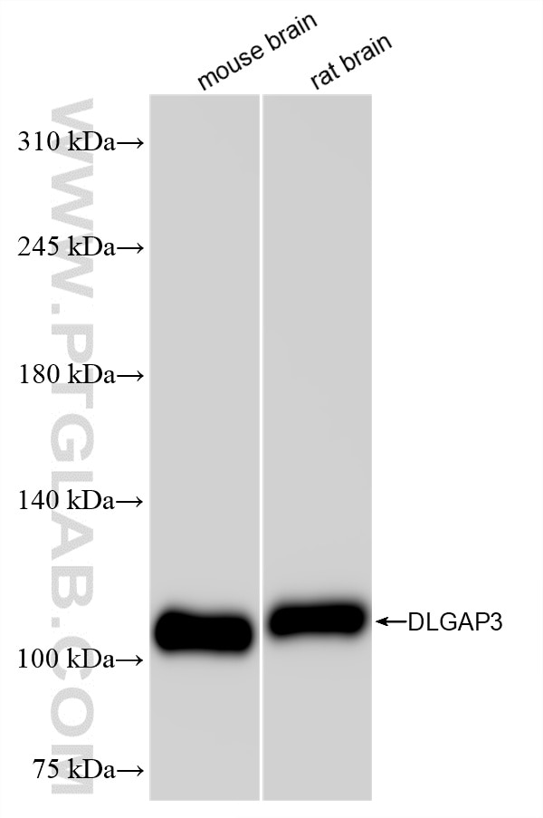 Western Blot (WB) analysis of various lysates using DLGAP3 Recombinant antibody (85695-1-RR)