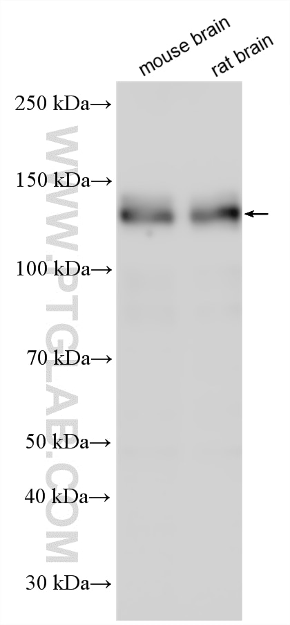 Western Blot (WB) analysis of various lysates using DLGAP4 Polyclonal antibody (33979-1-AP)
