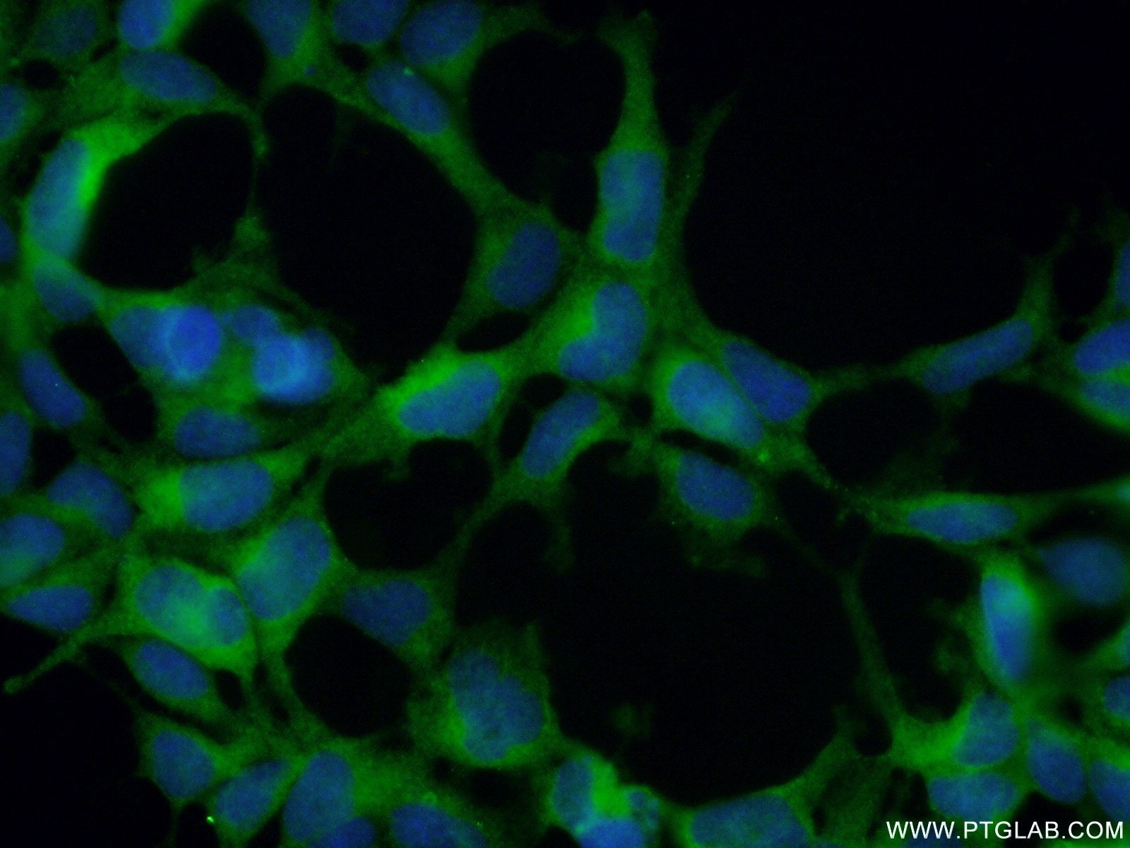 Immunofluorescence (IF) / fluorescent staining of HEK-293 cells using HURP Polyclonal antibody (12038-1-AP)