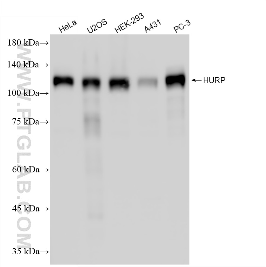 Western Blot (WB) analysis of various lysates using HURP Polyclonal antibody (12038-1-AP)