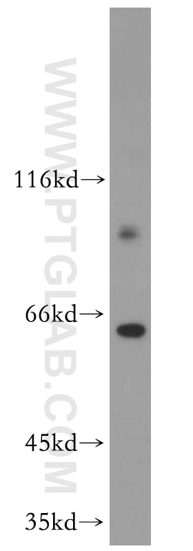 Western Blot (WB) analysis of HeLa cells using HURP Polyclonal antibody (12038-1-AP)