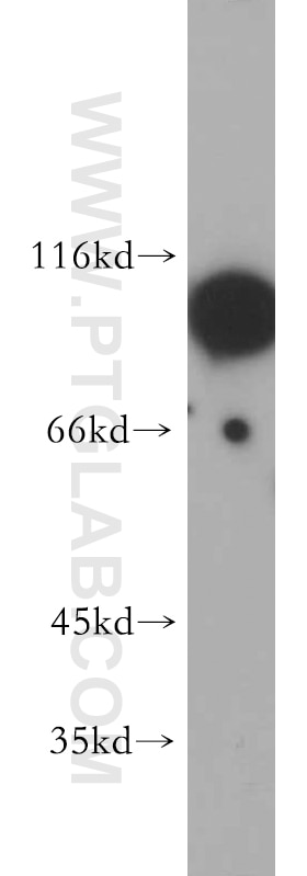 Western Blot (WB) analysis of HEK-293 cells using HURP Polyclonal antibody (12038-1-AP)