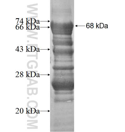 HURP fusion protein Ag2667 SDS-PAGE