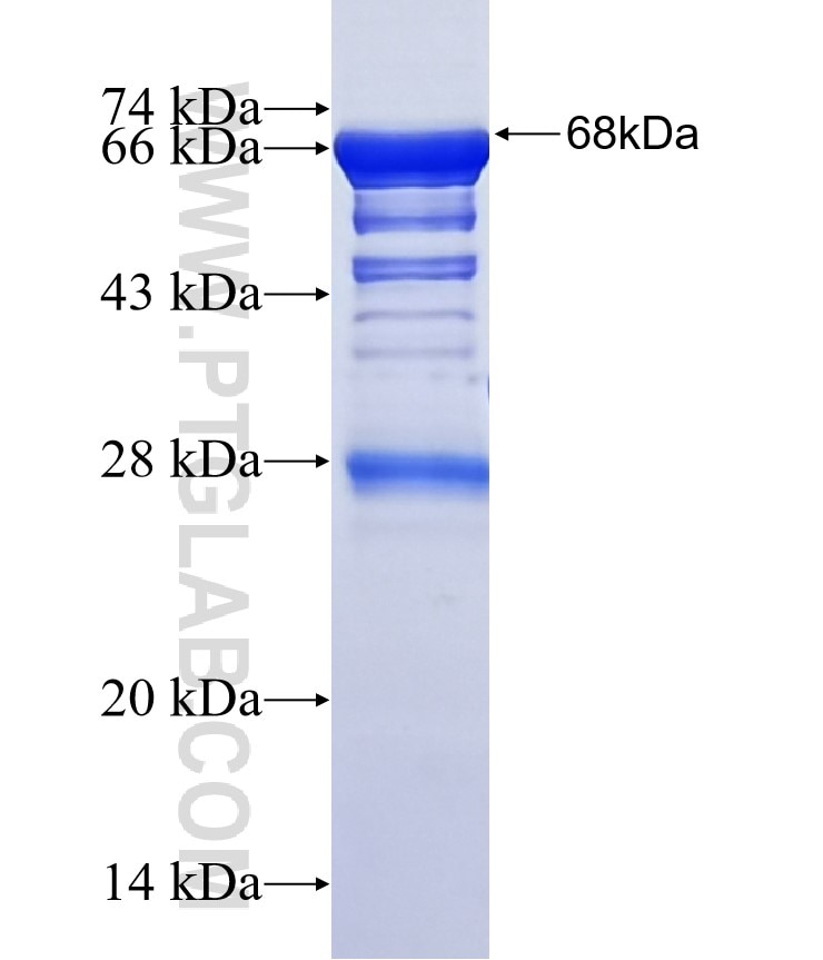 HURP fusion protein Ag2667 SDS-PAGE