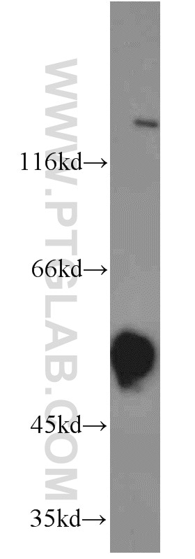 Western Blot (WB) analysis of A549 cells using DLK1 Polyclonal antibody (10636-1-AP)
