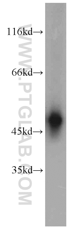 WB analysis of mouse ovary using 10636-1-AP