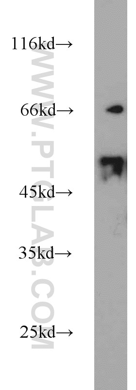 Western Blot (WB) analysis of MCF-7 cells using DLK1 Polyclonal antibody (10636-1-AP)