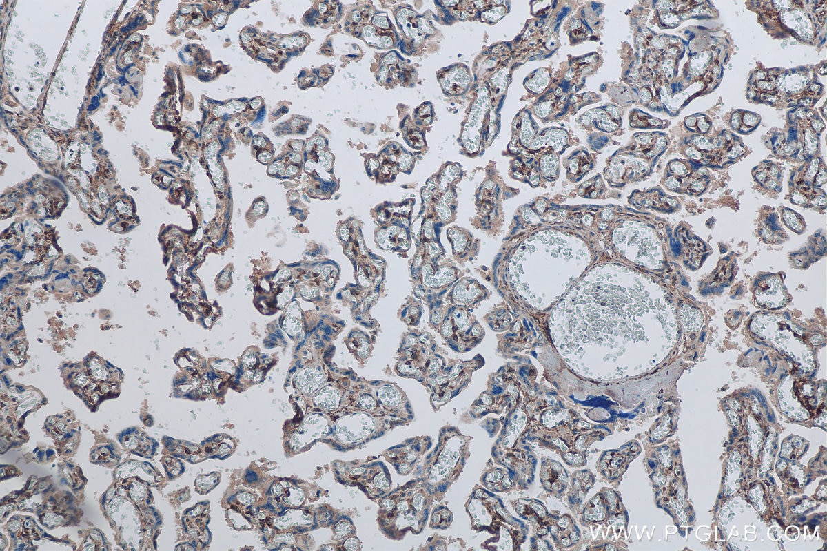 Immunohistochemistry (IHC) staining of human placenta tissue using DLK1 Polyclonal antibody (29288-1-AP)