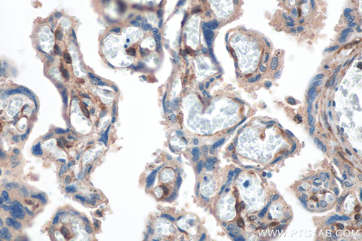 Immunohistochemistry (IHC) staining of human placenta tissue using DLK1 Polyclonal antibody (29288-1-AP)