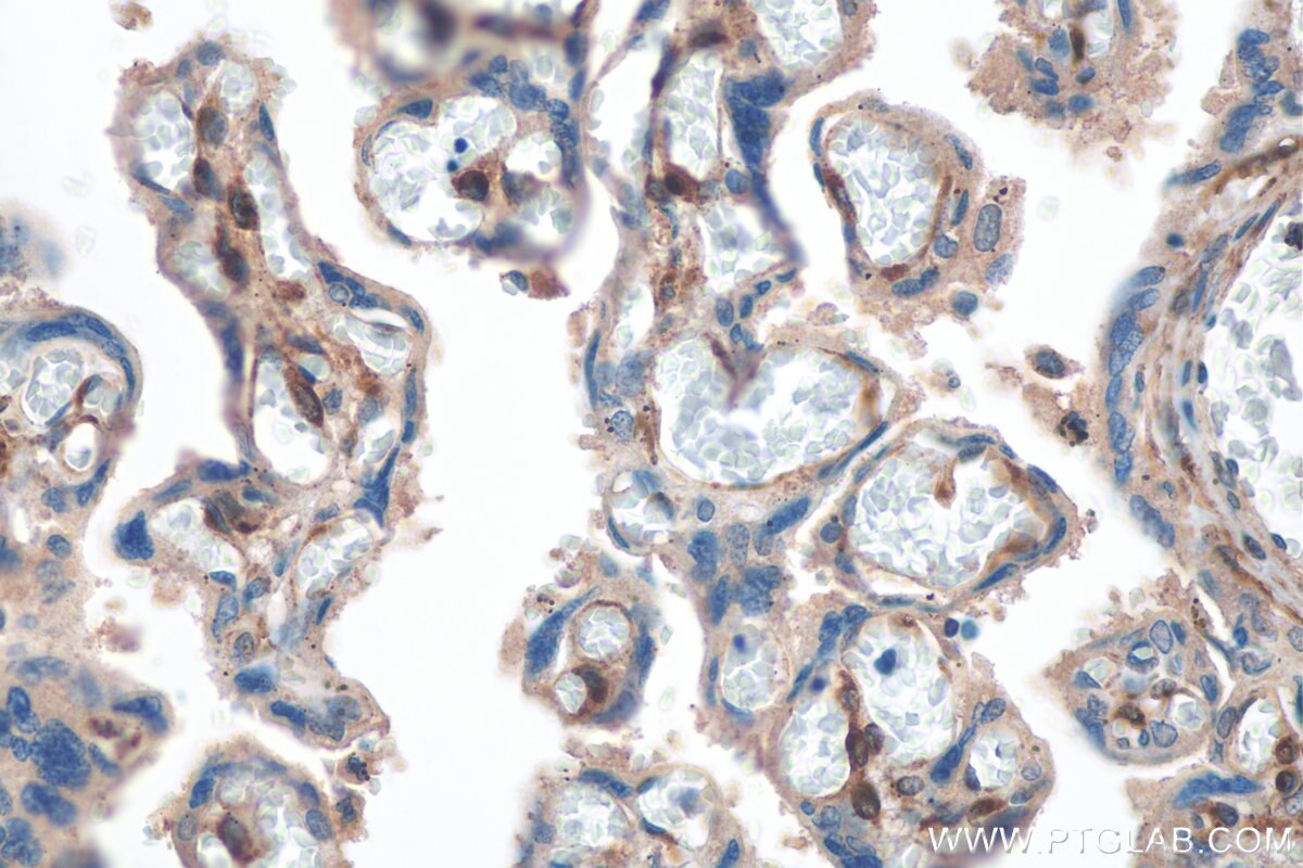 IHC staining of human placenta using 29288-1-AP