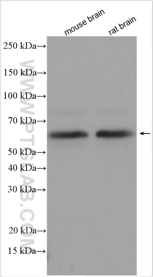 Western Blot (WB) analysis of various lysates using DLK1 Polyclonal antibody (29288-1-AP)