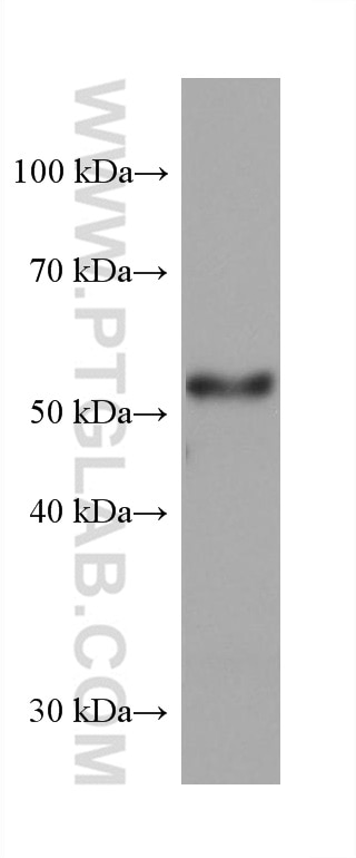 Western Blot (WB) analysis of pig adrenal gland tissue using DLK1 Monoclonal antibody (67923-1-Ig)