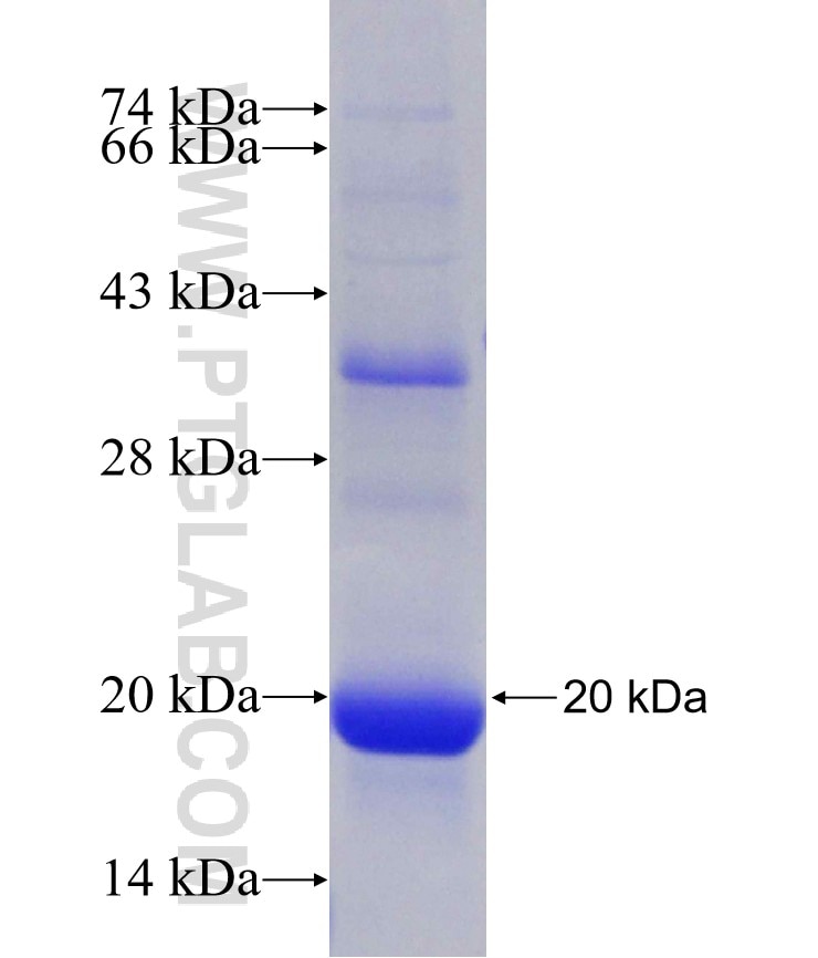 DLK1 fusion protein Ag30916 SDS-PAGE